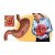 Gastritis