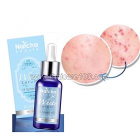 Natcha White Serum Acne & Acne Whitening Serum